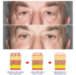 OPENEYES Awaken Lifting Eye Gel （1+1 Buy One Get One Free） - Image 5