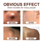 Skin Care Soothing Knot Care Cream Subcutaneous Lumps Remover Relieves Body Agglomeration Hard Blocks Body Skin Care Cream - Image 4