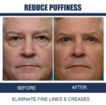 OPENEYES Awaken Lifting Eye Gel （1+1 Buy One Get One Free） - Image 4